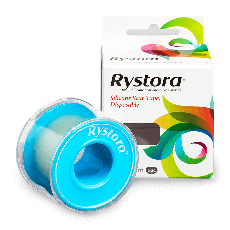 疤痕護理矽膠捲 : 