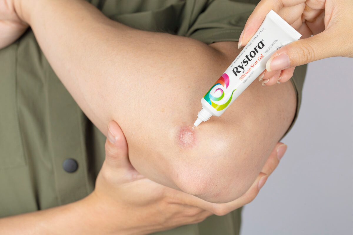 美得膚疤痕護理凝膠