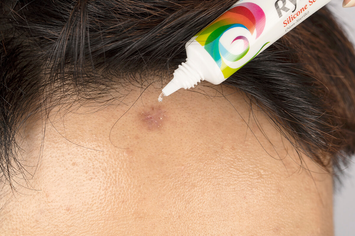 美得膚疤痕護理凝膠